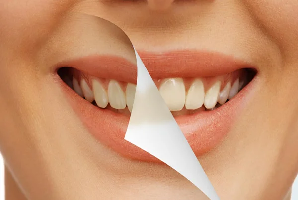 Cosmetic Dentistry