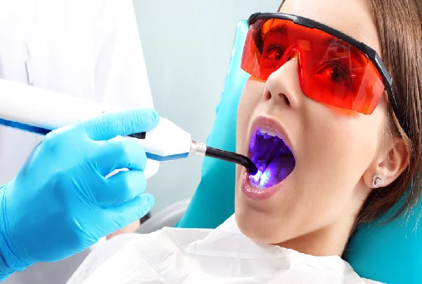 Laser Dentistry